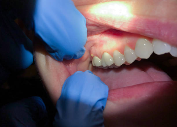 Best Mobile Emergency Dentist in Dyer, IN